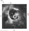 Fig. 01 - SYSTEMS AND METHODS FOR IDENTIFYING FEATURES SENSED BY A VASCULAR DEVICE