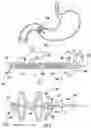 Fig. 02 - DEVICES, SYSTEMS, AND METHODS FOR PYLORIC OCCLUSION