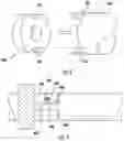 Fig. 05 - DEVICES, SYSTEMS, AND METHODS FOR PYLORIC OCCLUSION