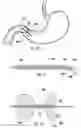 Fig. 06 - DEVICES, SYSTEMS, AND METHODS FOR PYLORIC OCCLUSION