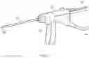 Fig. 03 - ELECTROSURGICAL DEVICE