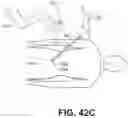 Fig. 49 - Robotically controllable field generators for tracking an medical instrument
