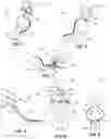 Fig. 02 - HANDS-FREE DENTAL SUCTION DEVICE