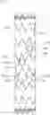 Fig. 01 - SYSTEM FOR BRANCHES FOR ENDOVASCULAR ENDOPROSTHESES AND CORRESPONDING ENDOPROSTHESIS FOR ENDOVASCLAR TREATMENT OF AORTIC ANEURYSMS OR DISSECTIONS