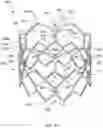 Fig. 04 - DEVICES AND METHODS FOR MULTI-ALIGNMENT OF IMPLANTABLE MEDICAL DEVICES