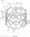 Fig. 13 - DEVICES AND METHODS FOR MULTI-ALIGNMENT OF IMPLANTABLE MEDICAL DEVICES
