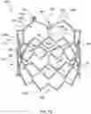 Fig. 19 - DEVICES AND METHODS FOR MULTI-ALIGNMENT OF IMPLANTABLE MEDICAL DEVICES