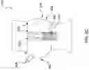 Fig. 22 - DEVICES AND METHODS FOR MULTI-ALIGNMENT OF IMPLANTABLE MEDICAL DEVICES
