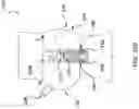 Fig. 28 - DEVICES AND METHODS FOR MULTI-ALIGNMENT OF IMPLANTABLE MEDICAL DEVICES
