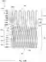 Fig. 30 - DEVICES AND METHODS FOR MULTI-ALIGNMENT OF IMPLANTABLE MEDICAL DEVICES