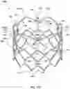 Fig. 31 - DEVICES AND METHODS FOR MULTI-ALIGNMENT OF IMPLANTABLE MEDICAL DEVICES