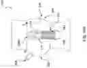 Fig. 34 - DEVICES AND METHODS FOR MULTI-ALIGNMENT OF IMPLANTABLE MEDICAL DEVICES