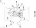 Fig. 56 - DEVICES AND METHODS FOR MULTI-ALIGNMENT OF IMPLANTABLE MEDICAL DEVICES