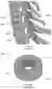 Fig. 05 - Porous composite biomaterials and related methods