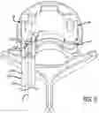Fig. 07 - Spinal implant