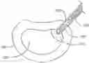 Fig. 01 - Soft tissue repair system
