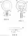 Fig. 04 - Soft tissue repair system