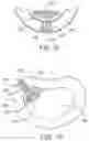 Fig. 05 - Soft tissue repair system