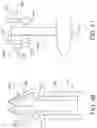 Fig. 28 - Soft tissue repair system