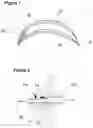 Fig. 02 - Volume-adaptable breast prosthesis