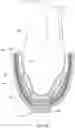 Fig. 17 - Prosthetic socket systems and methods