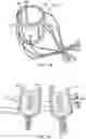 Fig. 19 - DYNAMIC SUPPORT APPARATUS