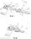 Fig. 07 - Hip Brace Kit