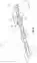 Fig. 10 - Hip Brace Kit