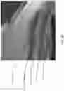 Fig. 06 - Image guidance methods and apparatus for glaucoma surgery