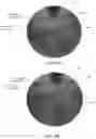Fig. 07 - Image guidance methods and apparatus for glaucoma surgery