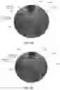 Fig. 08 - Image guidance methods and apparatus for glaucoma surgery
