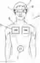 Fig. 01 - Medical device for improving environmental perception for blind or visually-impaired users
