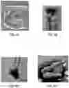 Fig. 09 - METHODS OF ACUTE RESTORATION OF VASCULAR COMPLIANCE
