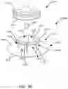 Fig. 20 - NEGATIVE PRESSURE WOUND THERAPY SYSTEM
