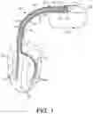 Fig. 02 - Automatic lead lock for an implantable medical device