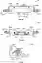 Fig. 08 - Display mounting systems and methods