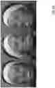 Fig. 08 - Video analysis for obtaining optical properties of a face