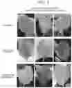 Fig. 02 - PLANT PATHOGEN CONTROL AGENT