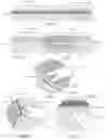 Fig. 04 - SYSTEMS AND METHODS FOR DEPOSITING MATERIAL IN A PATIENT