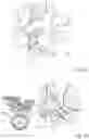 Fig. 04 - NOVEL SURGICAL METHODS FOR THE TREATMENT OF SPINAL STENOSIS