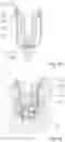 Fig. 08 - NOVEL SURGICAL METHODS FOR THE TREATMENT OF SPINAL STENOSIS