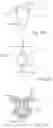 Fig. 10 - NOVEL SURGICAL METHODS FOR THE TREATMENT OF SPINAL STENOSIS