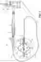 Fig. 02 - Real-time lesion formation assessment