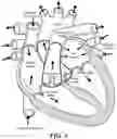 Fig. 07 - Real-time lesion formation assessment
