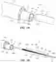 Fig. 06 - VALVULOPLASTY TREATMENT SYSTEM AND METHOD