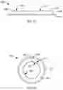 Fig. 06 - Biased artificial sphincter cuff