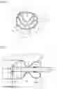 Fig. 06 - METHOD AND DEVICE FOR THE TRANS-ANAL DRAINAGE OF STOOL FROM THE RECTUM OF A PATIENT AND/OR FOR THE TRANS-ANAL APPLICATION OF INFLOWING LIQUID THROUGH A CATHETER-LIKE ELEMENT