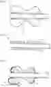 Fig. 09 - METHOD AND DEVICE FOR THE TRANS-ANAL DRAINAGE OF STOOL FROM THE RECTUM OF A PATIENT AND/OR FOR THE TRANS-ANAL APPLICATION OF INFLOWING LIQUID THROUGH A CATHETER-LIKE ELEMENT