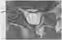 Fig. 01 - METHODS AND COMPOSITIONS TO FACILITATE REPAIR OF AVASCULAR TISSUE