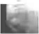 Fig. 04 - METHODS AND COMPOSITIONS TO FACILITATE REPAIR OF AVASCULAR TISSUE